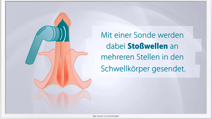 © www.tv-wartezimmer.de / TV-Wartezimmer_Stosswelle_ED_2 / Zum Vergrößern auf das Bild klicken